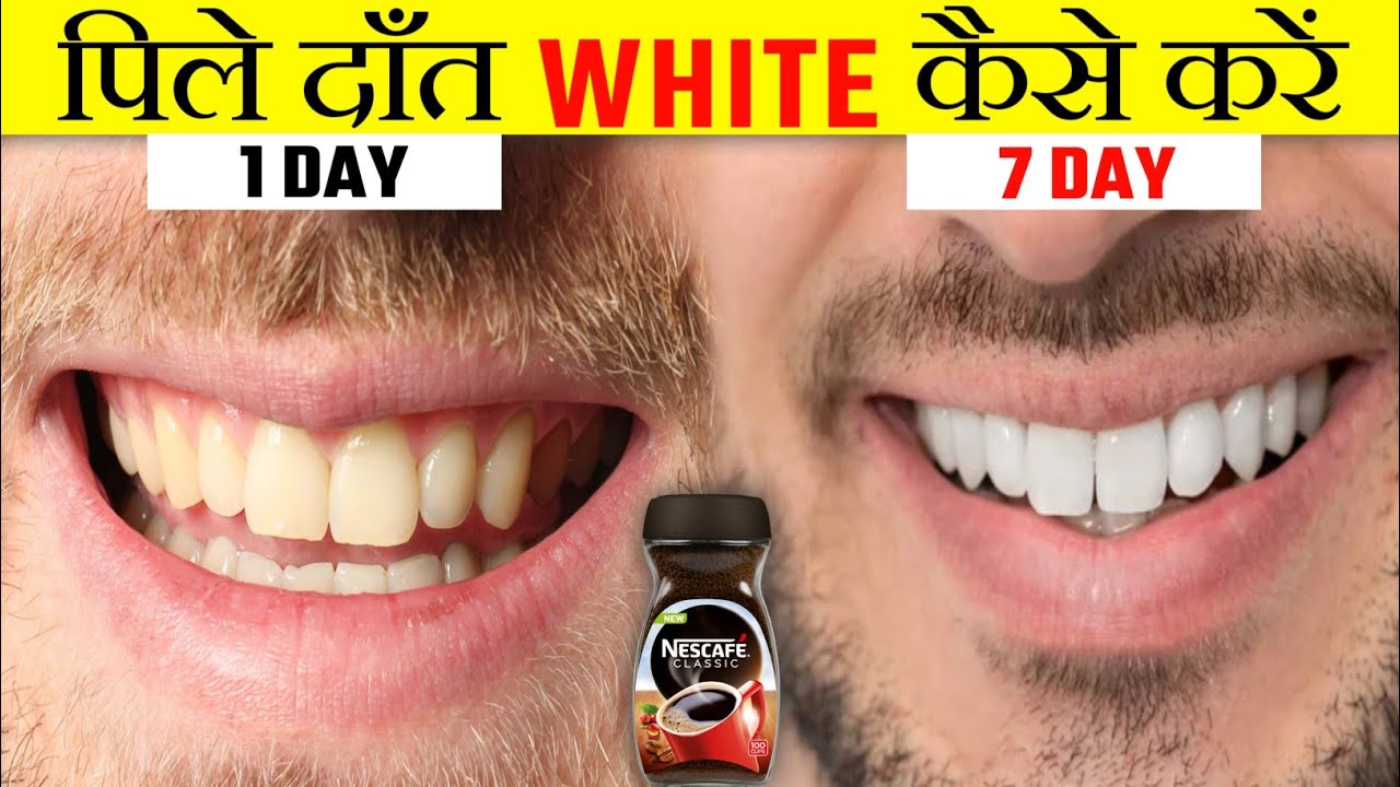 Secret Trick To Clean Yellow Teeth In Just 5 Minutes Random Facts secret-trick-to-clean-yellow-teeth-in-just-5-minutes-random-facts
