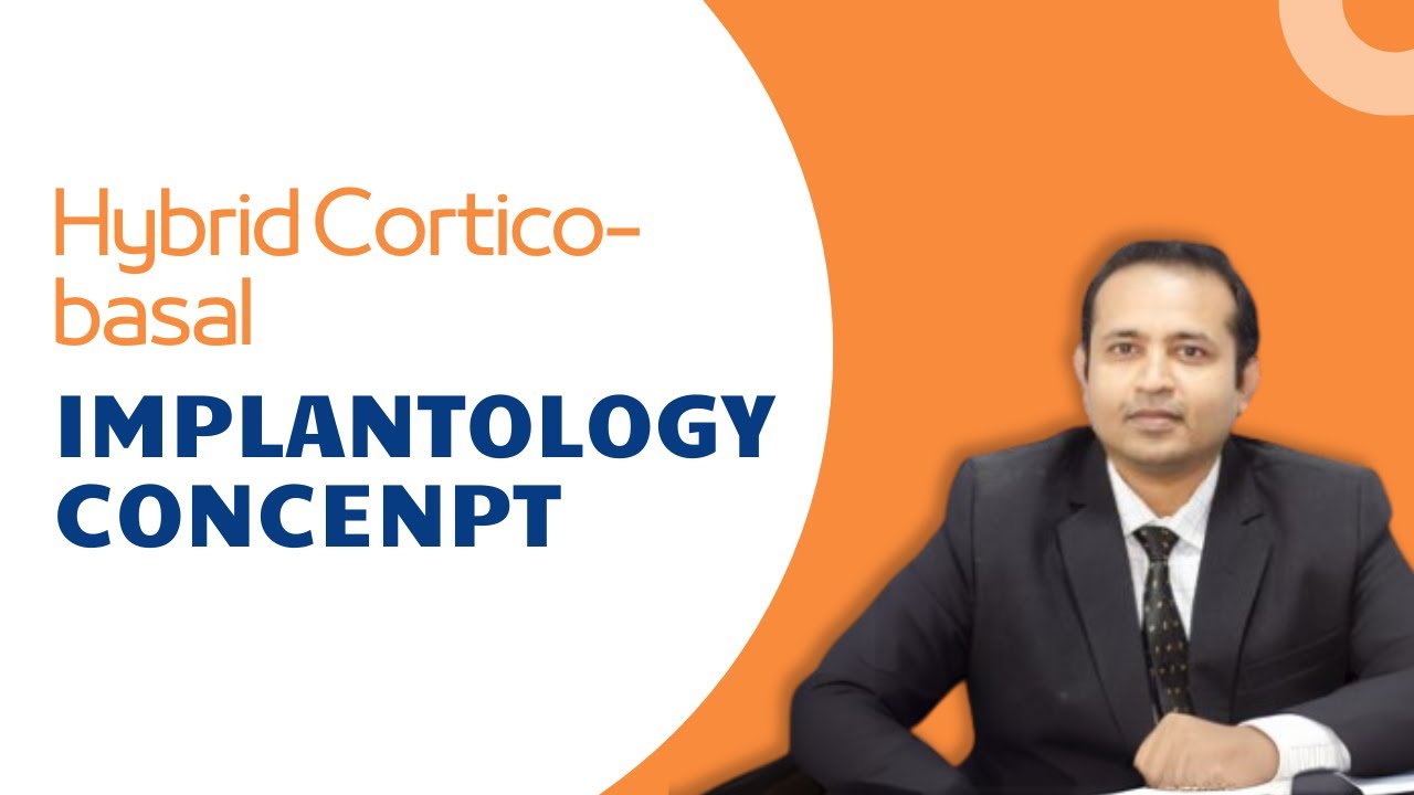 Hybrid CorticoBasal Implantology | Full Arch Treatment Approach by Dr. Nirav Gada | Quickdent