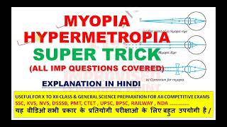 Best trick to learn Myopia and Hypermetropia | Myopia trick| Hypermetropia trick | Eye defects trick