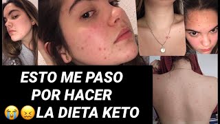 ESTO ME PASO POR HACER LA DIETA KETO (ENGORDE, ACNE, ANSIEDAD, DEPRESION, PROBLEMA HORMONAL).