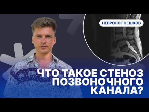 ЧТО ТАКОЕ СТЕНОЗ