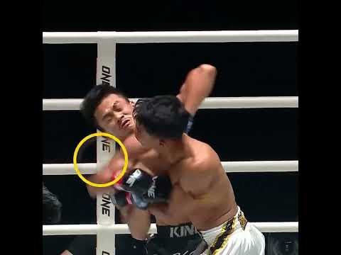 SHARP elbows 😳