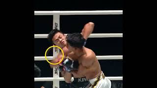 SHARP elbows 😳