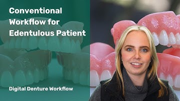 Digital Denture Workflow: Conventional Workflow for Edentulous Patient