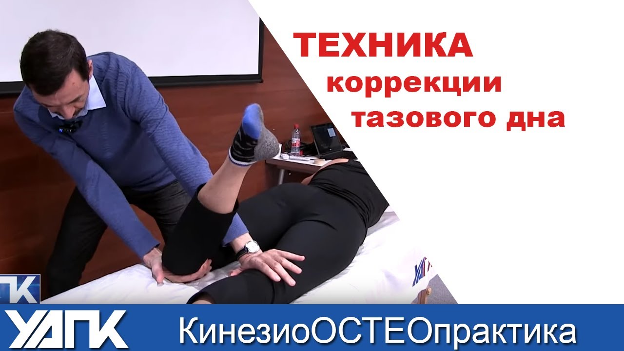 Опущение мышц тазового дна фото