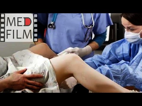 Video: İlk nevraksiyal anesteziya nə vaxt olub?