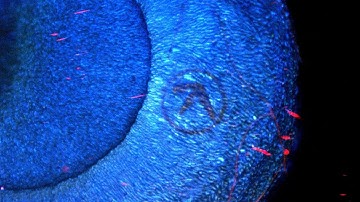 BIO-ART: AFX - Pulsewidth - LASER bleaching fungi at the cellular level.