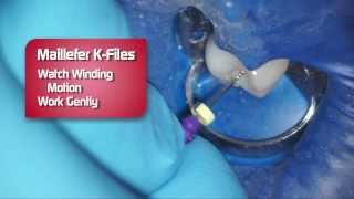 Dentsply K-Files - Review by Dr. Scott Norton