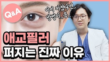 애교필러 나도 퍼질까? 애교필러 퍼짐이 걱정된다면 필수시청! ✔✨ㅣ애교필러 Q&A