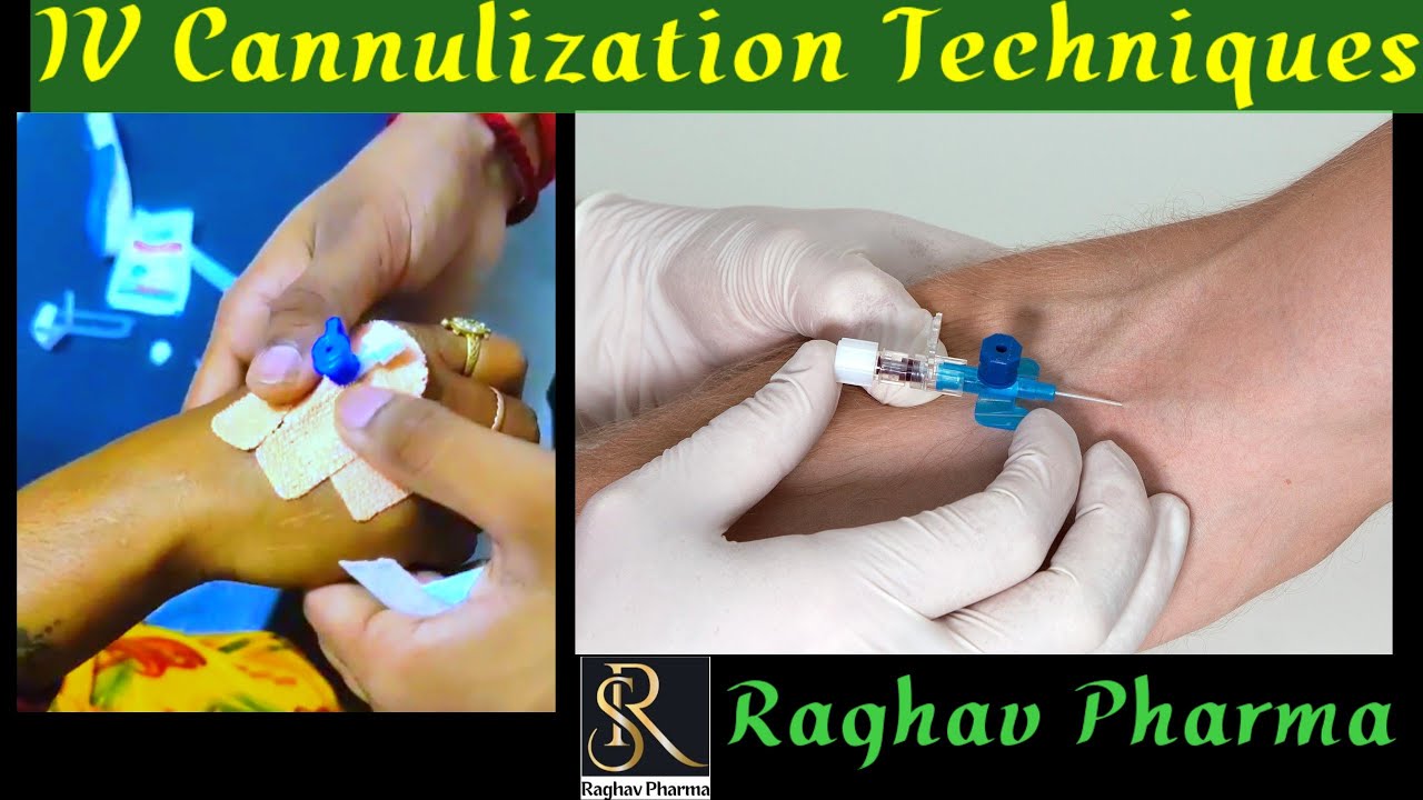 IV Cannulization Techniques // सही IV Cannula कैसे लगाए // Raghav ...