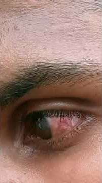 दिल पर हम चोट खा कर रो पड़े