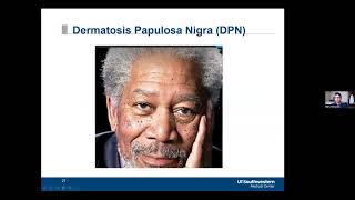 Anyone Can Get Skin Cancer – Including People of Color