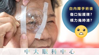 中大眼科 x 港台做完白內障手術傷口點護理視力幾時清