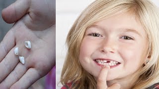 Dentists Are Warning Us – DON`T THROW AWAY BABY TEETH, They Can Save Your Child`s Life!!