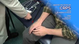 How to Diagnose CRPS by Utilizing the Budapest Criteria  RSDSA