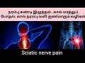 Home remedies for sciatic nerve pain         