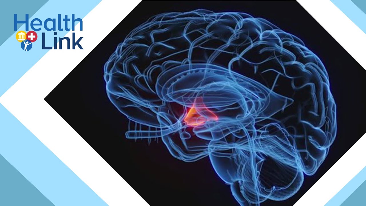 Why some antidepressant medication can cause more sweating: HealthLink