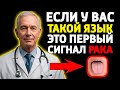 ВРАЧ БЬЕТ ТРЕВОГУ: 90% Людей Списывают Эти 5 Симптомов Рака на «Возраст»!