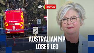 Australian MP loses leg as counter-terrorism police investigate 'deliberate act'