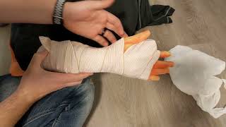 Splinting Unstable Wrist Injuries