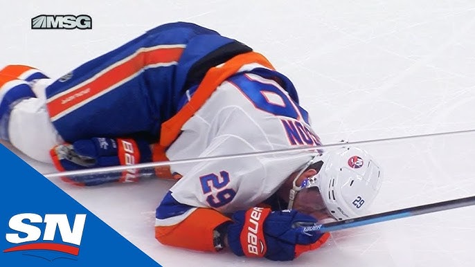 Islanders' Brock Nelson pulls his own tooth out during game