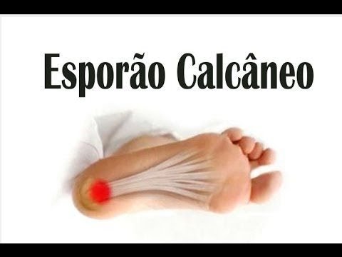 Vídeo: Dor No Calcanhar: Causas, Tratamentos E Prevenção