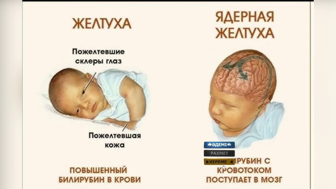 Ірі пішімдегі жоптың фотосы