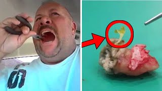 What Dentist Found Inside Man's Tooth Makes Him Call The News Immediately - No One Believed Him! by Did You Know ? 508 views 2 hours ago 4 minutes, 5 seconds