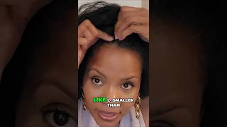Your hair can't out run a bad diet!#naturalhairgrowth #hairloss