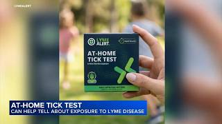 At-home tick test can help detect lyme disease