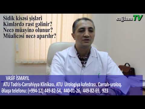 saglamTV. Uroloq. Vasif İsmayıl. Sidik kisəsi şişləri kimlərdə rast gəlinir və necə müalicə olunur?