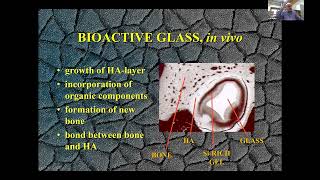 Download Lagu Inion Webinar: Erik Vedel - History of Bioactive Glass MP3