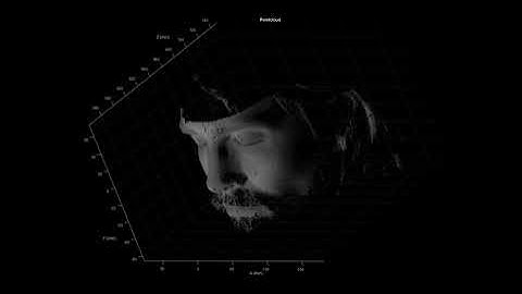 Short-range high-resolution 3D real-time imaging for robotic vision