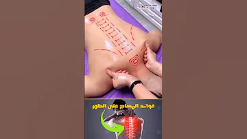 مساج على الظهر بطريقة احترافية المساج الحجامة الجافة الحجامة Hijama الحجامة Cupping 