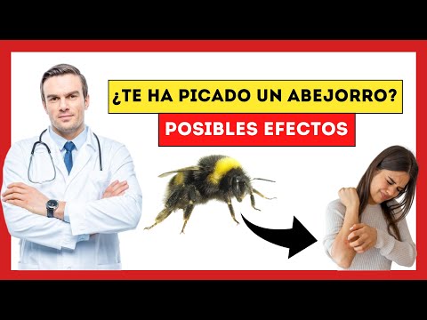 Video: ¿Los abejorros orientales comunes pican?