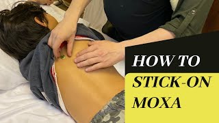 How to use stick-on moxa - for acupuncturists and patients