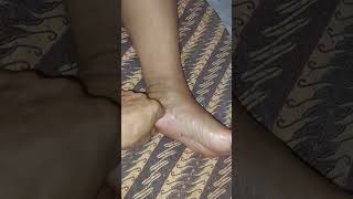 Pijat Refleksi Saluran Kemih