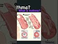 Was ist Asthma? Wie wirkt es sich auf die Lunge aus? Link zum Video in der Beschreibung!