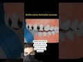 BABIES Get Cavities?! (Explaining Baby Bottle Caries)
