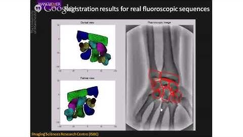13:55 - Computer Aided Diagnosis
