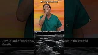 Structural Cause Of Heart Palpitations Neck Instability cervicalspine  vagopathy vagusnerve