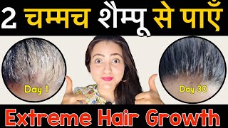 Lost Hair Growth Challenge : बस 2 चम्मच शैम्पू के साथ USE करें, पाएं Long, Thick & Denser Hair❤️