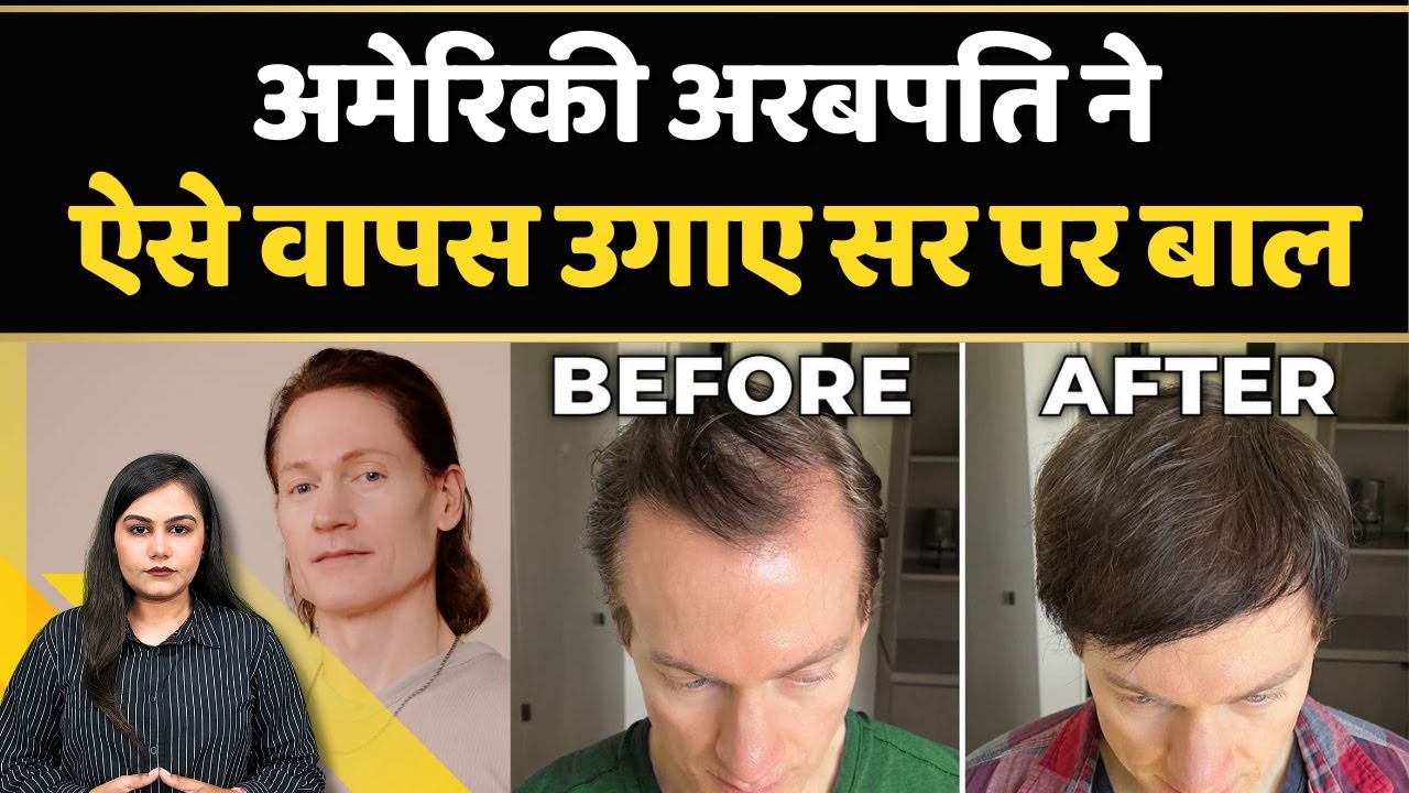 Bryan Johnson ने खोज निकाला है सर पर वापस बाल उगाने का समाधान | News Connect