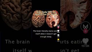 Your Brain Will Eat Itself If You Do This 😰 #disturbing