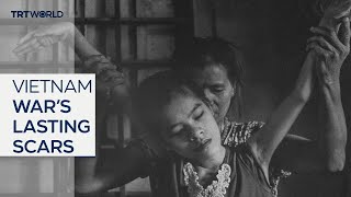 Battle with Agent Orange continues 50 years after Vietnam War