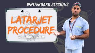 How to do a Latarjet Procedure