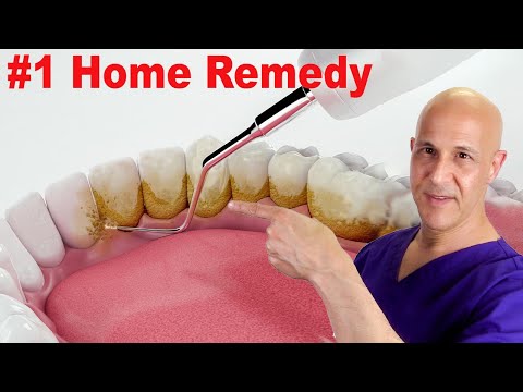 #1 Home Remedy to Remove Dental Plaque & Tarter to Prevent Cavities | Dr.