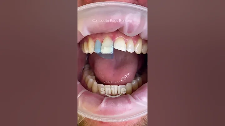 Composite Edge Bonding Transformation #shorts