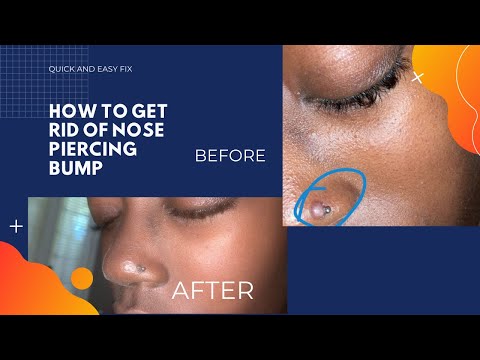 CARA MENYINGKIRKAN HIDUNG PIERCING BUMP (5 menit fix)