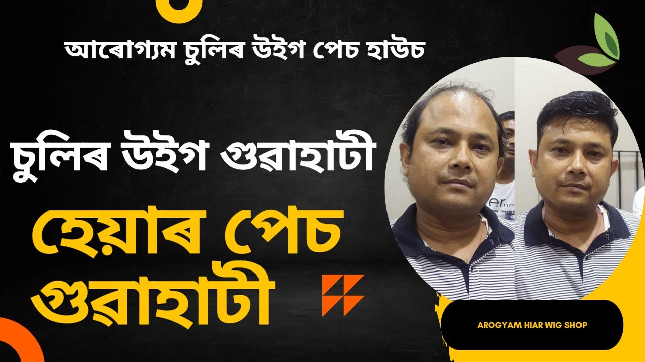 Hair Wig Guwahati || Hair Patch Guwahati (অসমীয়া)